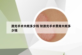 激光手术大概多少钱 钬激光手术费用大概多少钱