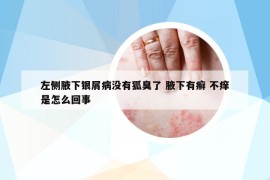 左侧腋下银屑病没有狐臭了 腋下有癣 不痒是怎么回事