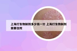 上海打生物制剂多少钱一针 上海打生物制剂需要住院