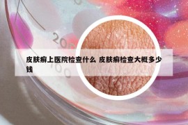 皮肤癣上医院检查什么 皮肤癣检查大概多少钱