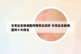 石家庄皮肤病医院哪家比较好 石家庄皮肤病医院十大排名