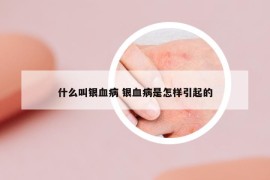 什么叫银血病 银血病是怎样引起的