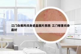 江门白癜风纹身遮盖图片西西 江门哪里纹身最好