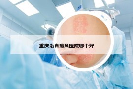 重庆治白癜风医院哪个好