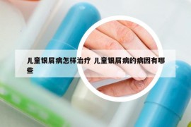 儿童银屑病怎样治疗 儿童银屑病的病因有哪些