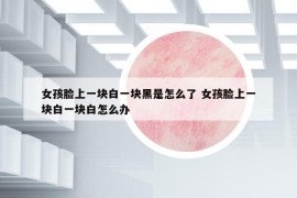 女孩脸上一块白一块黑是怎么了 女孩脸上一块白一块白怎么办