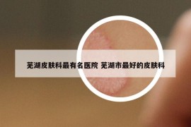 芜湖皮肤科最有名医院 芜湖市最好的皮肤科