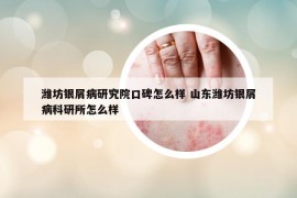 潍坊银屑病研究院口碑怎么样 山东潍坊银屑病科研所怎么样