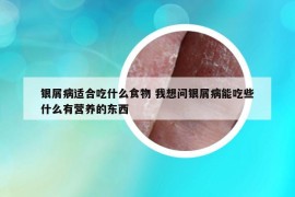 银屑病适合吃什么食物 我想问银屑病能吃些什么有营养的东西