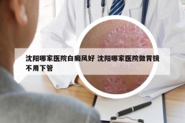 沈阳哪家医院白癜风好 沈阳哪家医院做胃镜不用下管