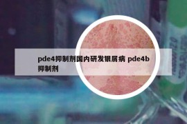 pde4抑制剂国内研发银屑病 pde4b抑制剂