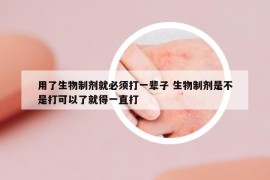 用了生物制剂就必须打一辈子 生物制剂是不是打可以了就得一直打