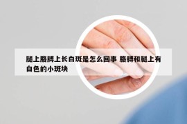 腿上胳膊上长白斑是怎么回事 胳膊和腿上有白色的小斑块