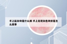 手上起白块是什么病 手上出现白色块状是怎么回事