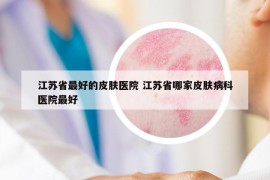 江苏省最好的皮肤医院 江苏省哪家皮肤病科医院最好