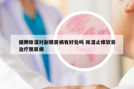 健脾除湿对副银屑病有好处吗 除湿止痒软膏治疗银屑病