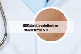 银屑病zhiliaoxinjinzhan 银屑病治疗新方法