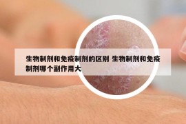 生物制剂和免疫制剂的区别 生物制剂和免疫制剂哪个副作用大