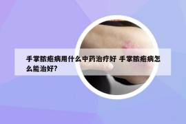 手掌脓疱病用什么中药治疗好 手掌脓疱病怎么能治好?