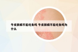 牛皮肤癣不能吃鱼吗 牛皮肤癣不能吃鱼吗为什么