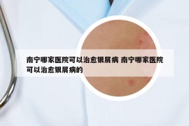 南宁哪家医院可以治愈银屑病 南宁哪家医院可以治愈银屑病的