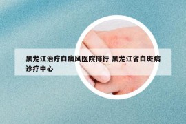 黑龙江治疗白癜风医院排行 黑龙江省白斑病诊疗中心