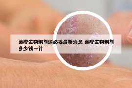 湿疹生物制剂达必妥最新消息 湿疹生物制剂多少钱一针