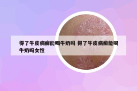 得了牛皮病癣能喝牛奶吗 得了牛皮病癣能喝牛奶吗女性