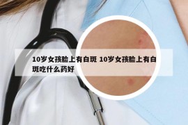 10岁女孩脸上有白斑 10岁女孩脸上有白斑吃什么药好