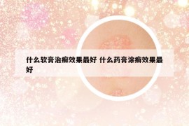 什么软膏治癣效果最好 什么药膏涂癣效果最好