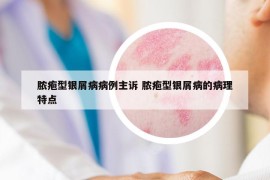 脓疱型银屑病病例主诉 脓疱型银屑病的病理特点