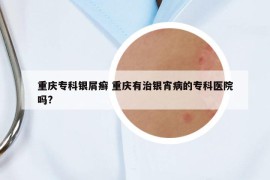 重庆专科银屑癣 重庆有治银宵病的专科医院吗?