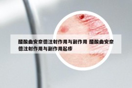 醋酸曲安奈德注射作用与副作用 醋酸曲安奈德注射作用与副作用起疹