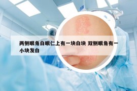 两侧眼角白眼仁上有一块白块 双侧眼角有一小块发白