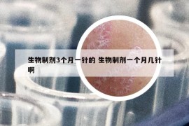 生物制剂3个月一针的 生物制剂一个月几针啊