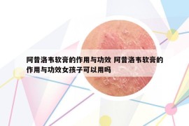 阿昔洛韦软膏的作用与功效 阿昔洛韦软膏的作用与功效女孩子可以用吗