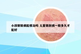 小孩银销病能根治吗 儿童银削病一般多久才能好