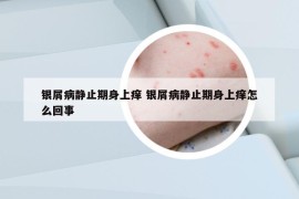 银屑病静止期身上痒 银屑病静止期身上痒怎么回事