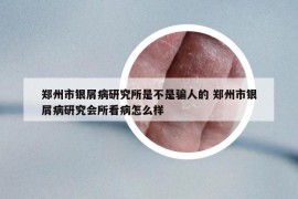 郑州市银屑病研究所是不是骗人的 郑州市银屑病研究会所看病怎么样