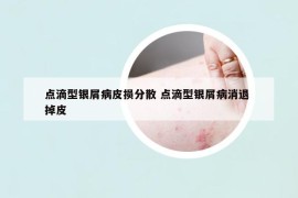 点滴型银屑病皮损分散 点滴型银屑病消退 掉皮