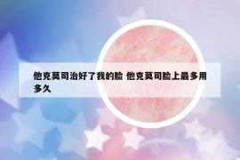 他克莫司治好了我的脸 他克莫司脸上最多用多久