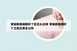 掌跖脓疱病痒好了后怎么还痒 掌跖脓疱病好了之后还用忌口吗