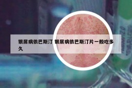 银屑病依巴斯汀 银屑病依巴斯汀片一般吃多久