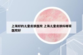 上海好的儿童皮肤医院 上海儿童皮肤科哪家医院好