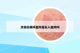 济南白癜风医院是私人医院吗