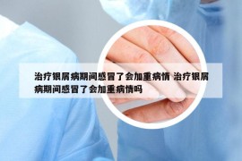 治疗银屑病期间感冒了会加重病情 治疗银屑病期间感冒了会加重病情吗