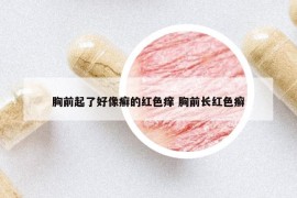 胸前起了好像癣的红色痒 胸前长红色癣