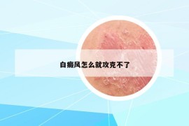 白癜风怎么就攻克不了