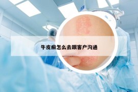 牛皮癣怎么去跟客户沟通