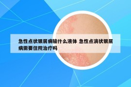 急性点状银屑病输什么液体 急性点滴状银屑病需要住院治疗吗